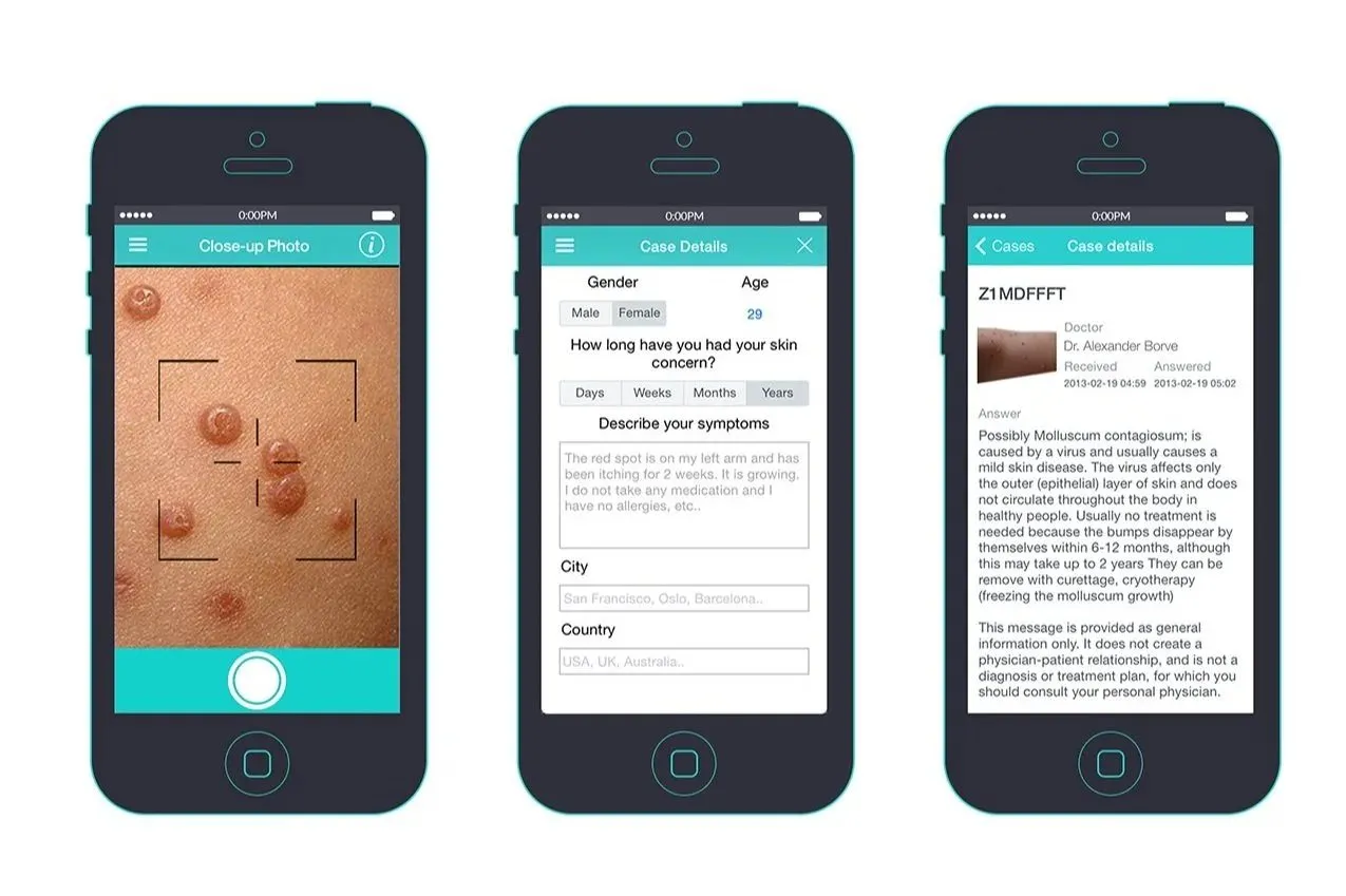 Figure: Telemedicine - First Derm manufactured by iDoc24